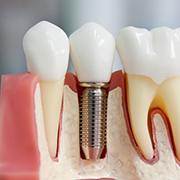 Как выбрать себе стоматолога и клинику
